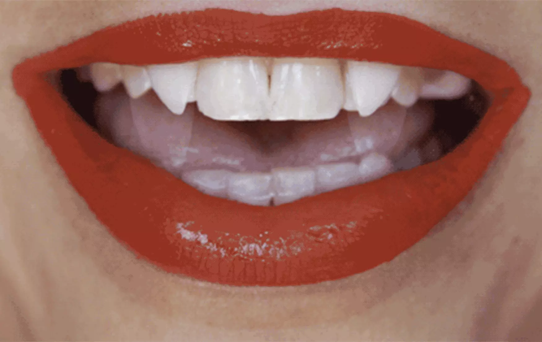 Scarecrow Inc. Default Up Retractable Fangs 1 Scarecrow Inc. Default Up Retractable Fangs