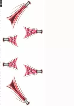 Tinsley Transfers Trauma Stretched Temporary Costume Tattoo -Scary Costumes store trauma stretched temporary tattoo alt 2